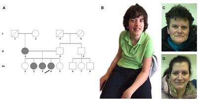 Case Report: Expressive Speech Disorder in a Family as a Hallmark of 7q31 Deletion Involving the FOXP2 Gene